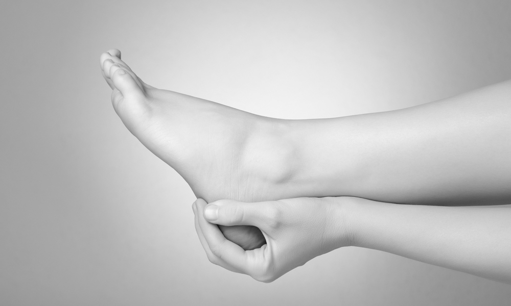 PLANTAR FASCITIS