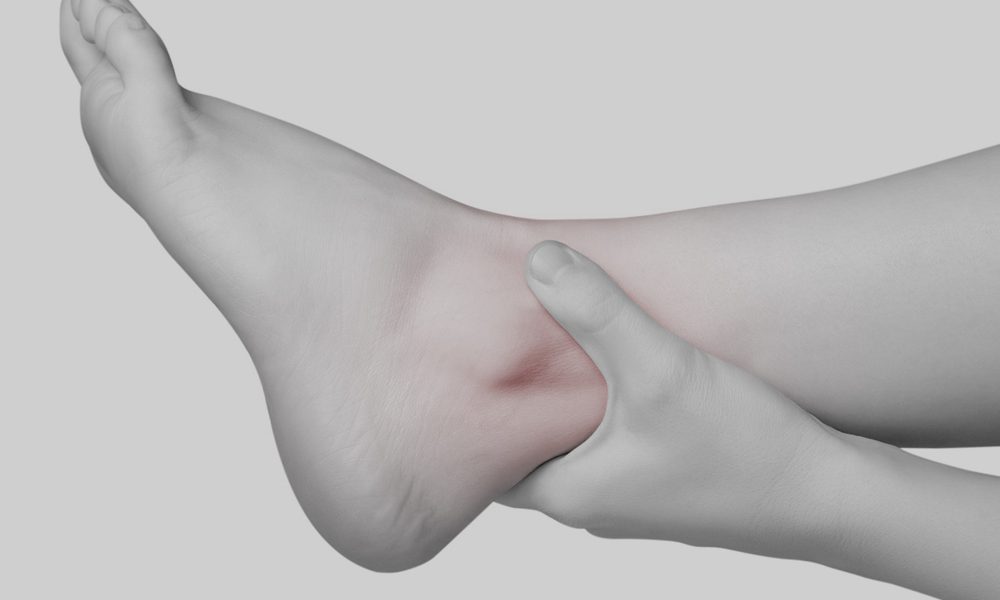 ANKLE INJECTION