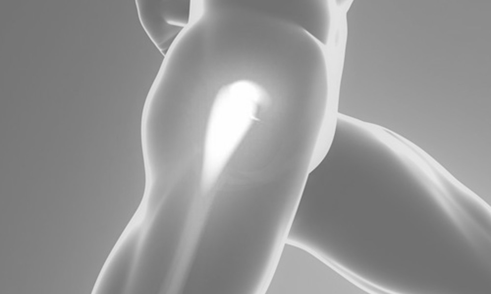 Cartilage Tears & Impingement